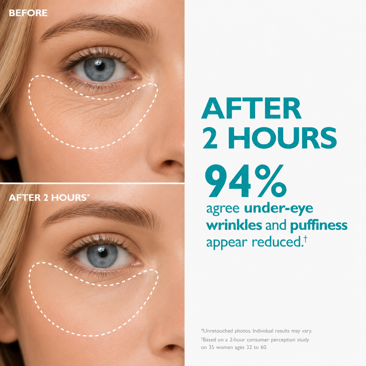 LiftTape™: Peptide-Infused Anti-Aging Strips